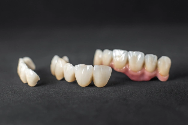Dental crowns and bridges displayed on dark background showing various tooth restoration options.