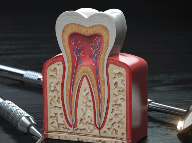 Dental anatomy model showing tooth cross-section with pulp chamber, nerves, and root structure.