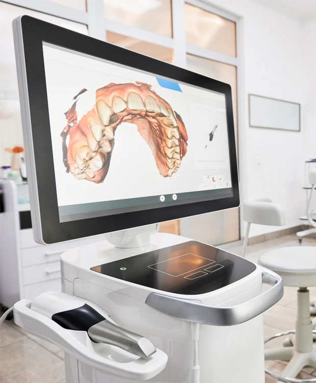 3D digital impressions using at Arbor Oaks Dental Office in Austin
